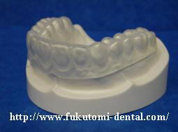 ソフトタイプリテーナー(可撤式)